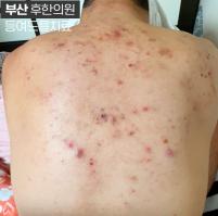 전후사진