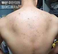 전후사진