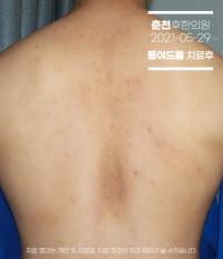전후사진