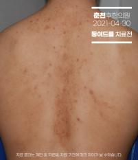 전후사진
