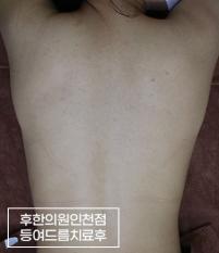 전후사진