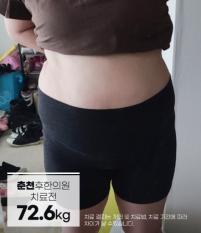 전후사진