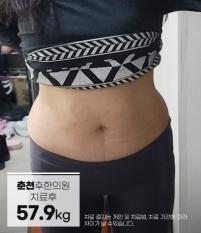 전후사진
