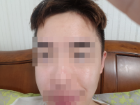 치료 후