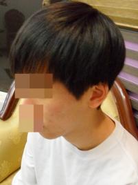 전후사진