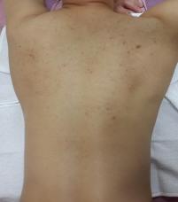 전후사진