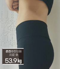 전후사진