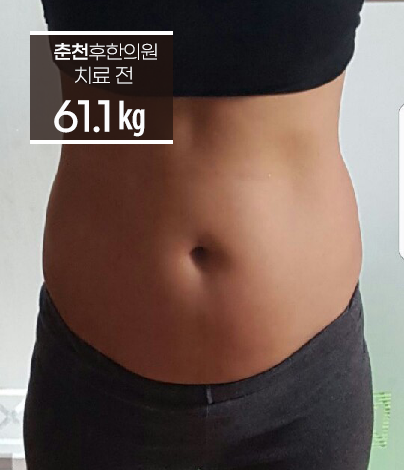 전후사진