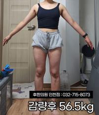 전후사진