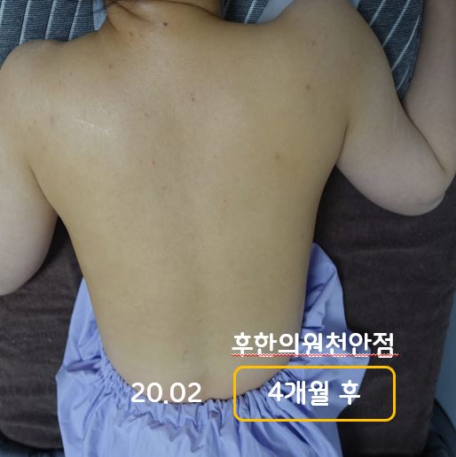 전후사진