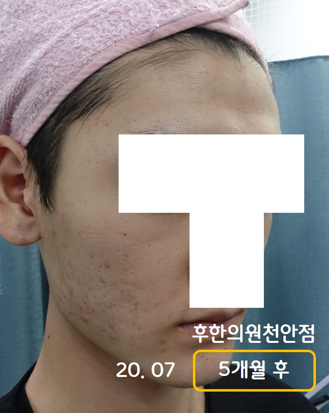 전후사진