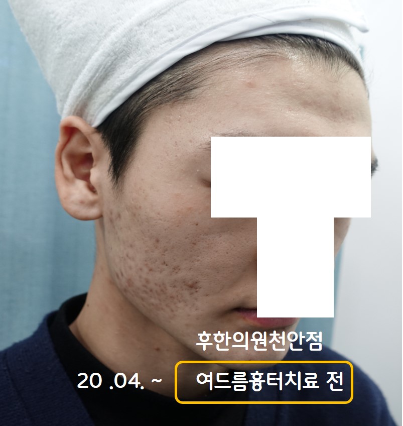 전후사진