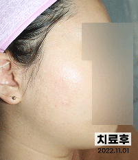 전후사진
