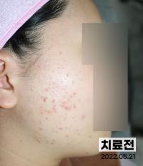 전후사진