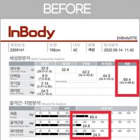 전후사진