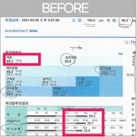 전후사진