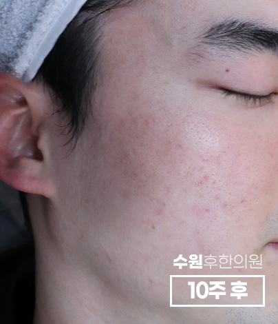 전후사진