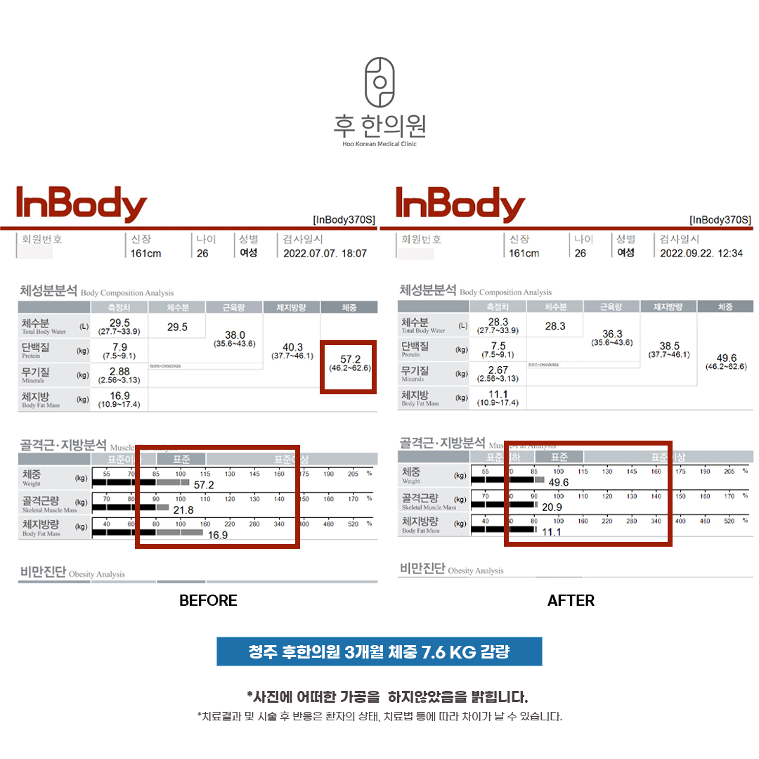 전후사진