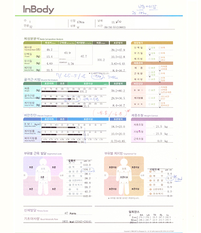 전후사진