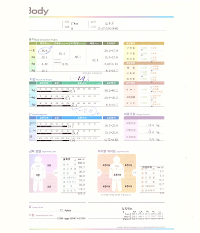 전후사진