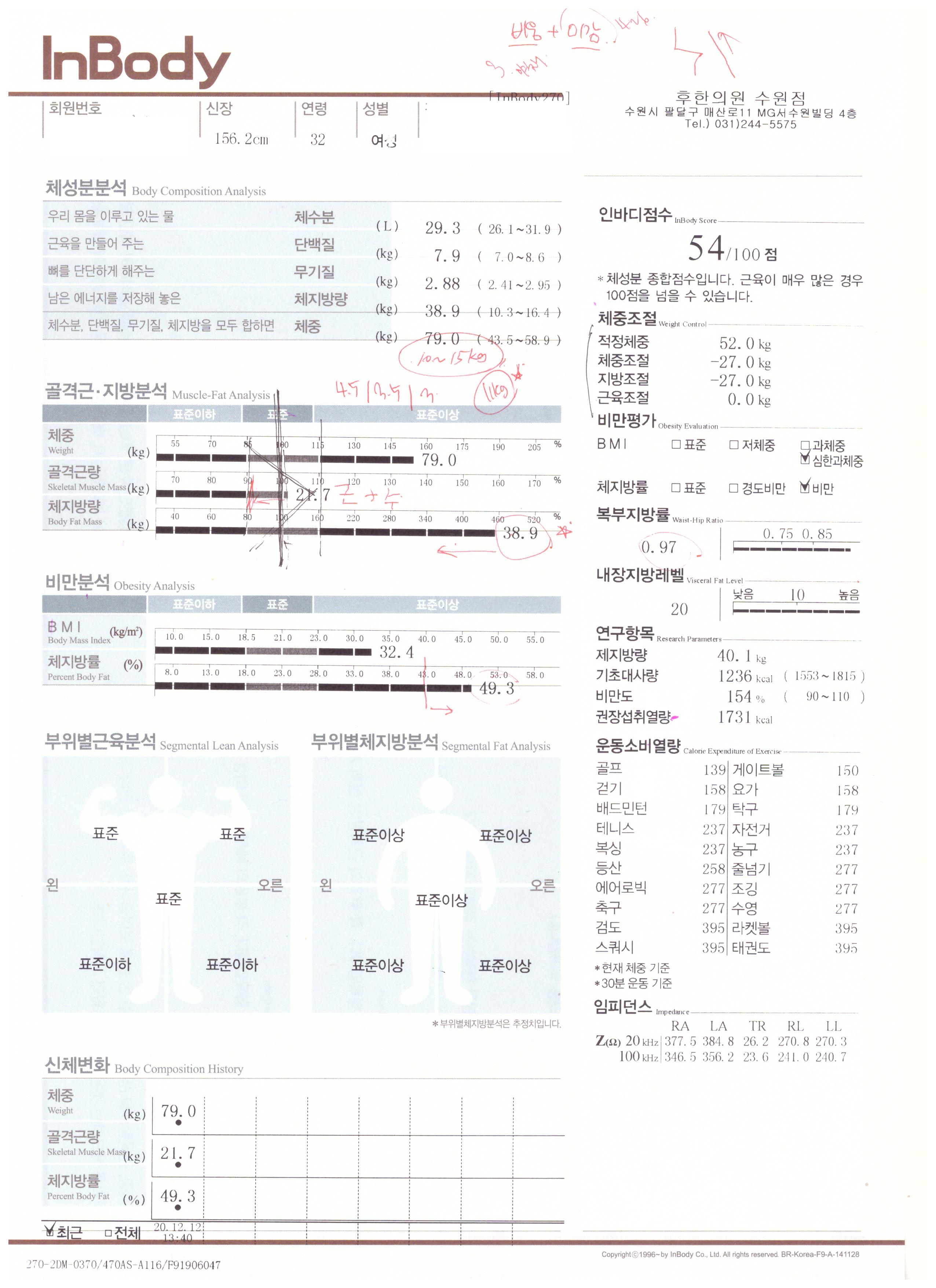 전후사진