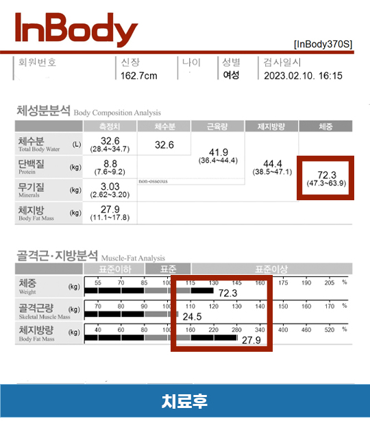 전후사진