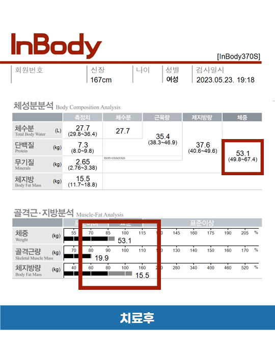 전후사진