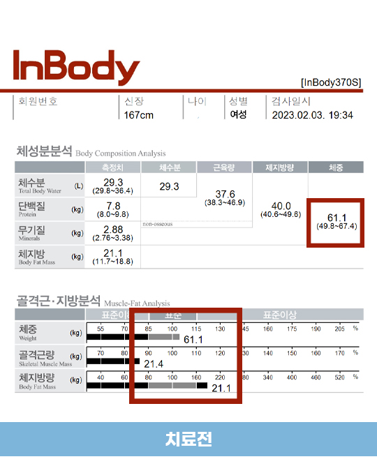 전후사진