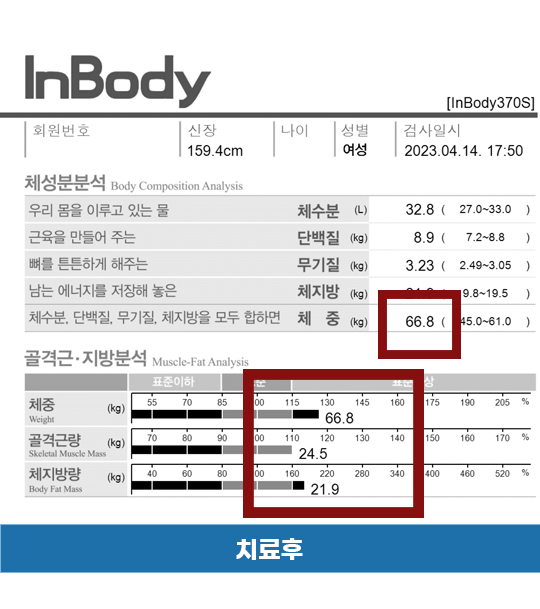 전후사진