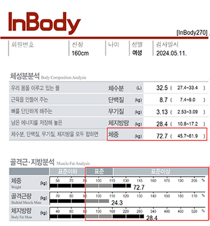 전후사진