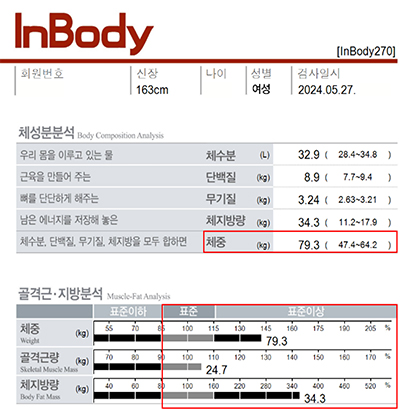 전후사진