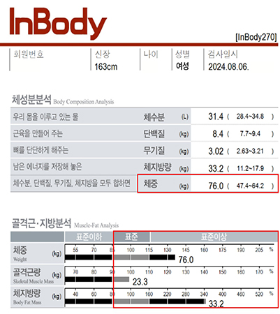 전후사진