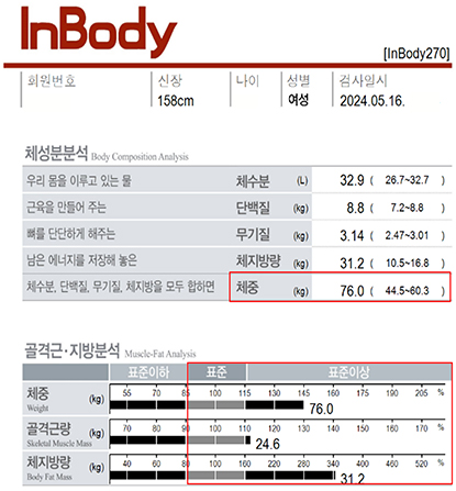 전후사진