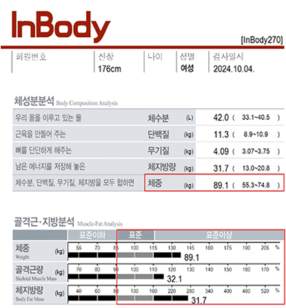 전후사진