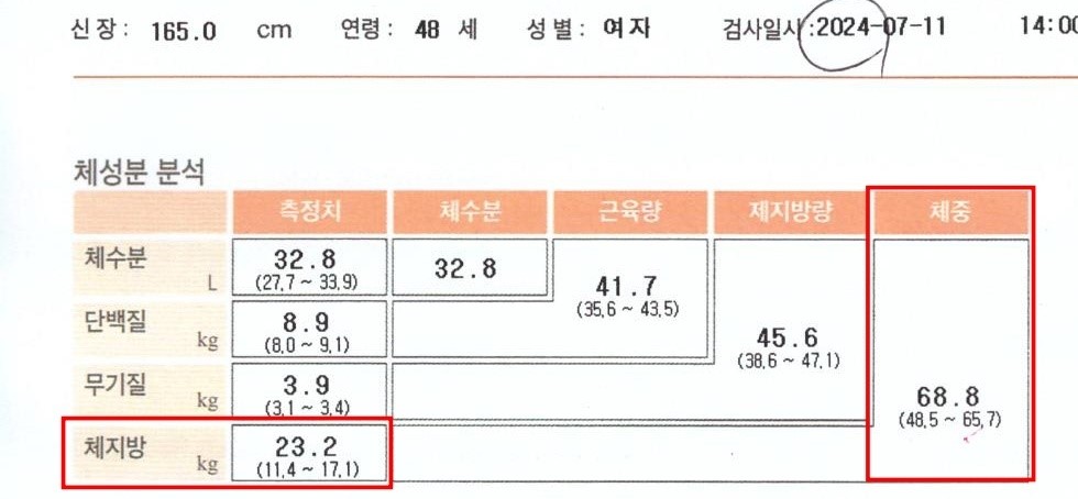 전후사진