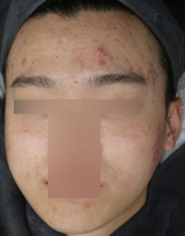 전후사진