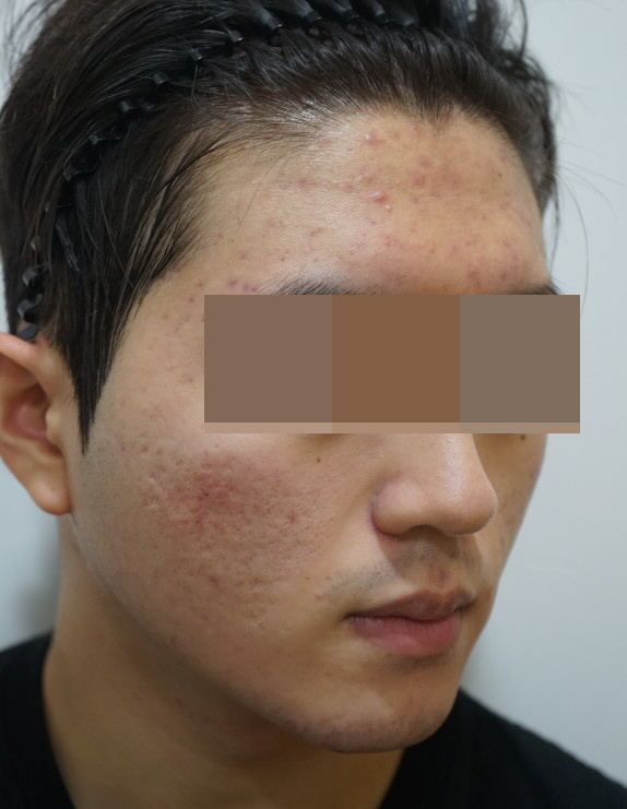 전후사진
