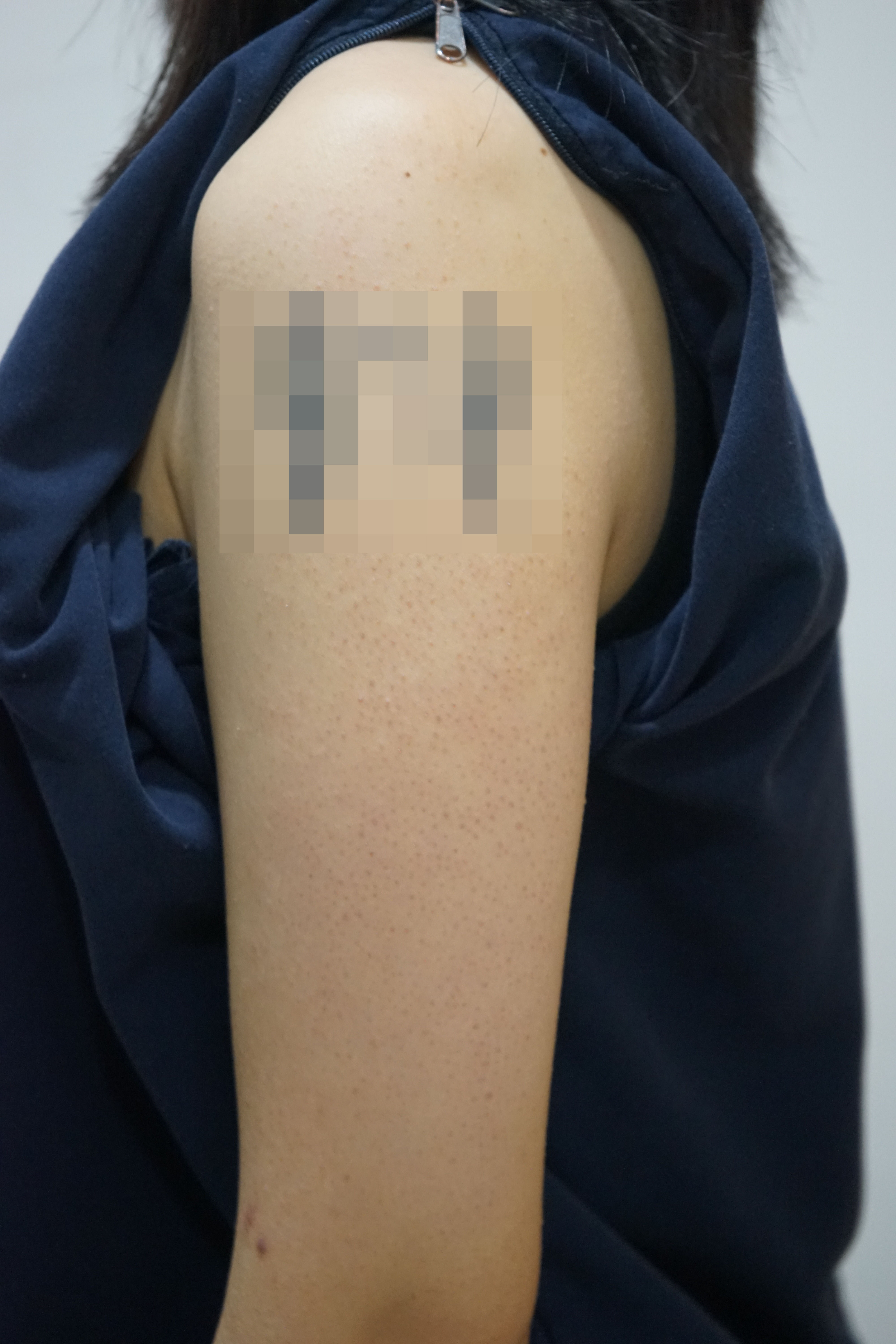 전후사진