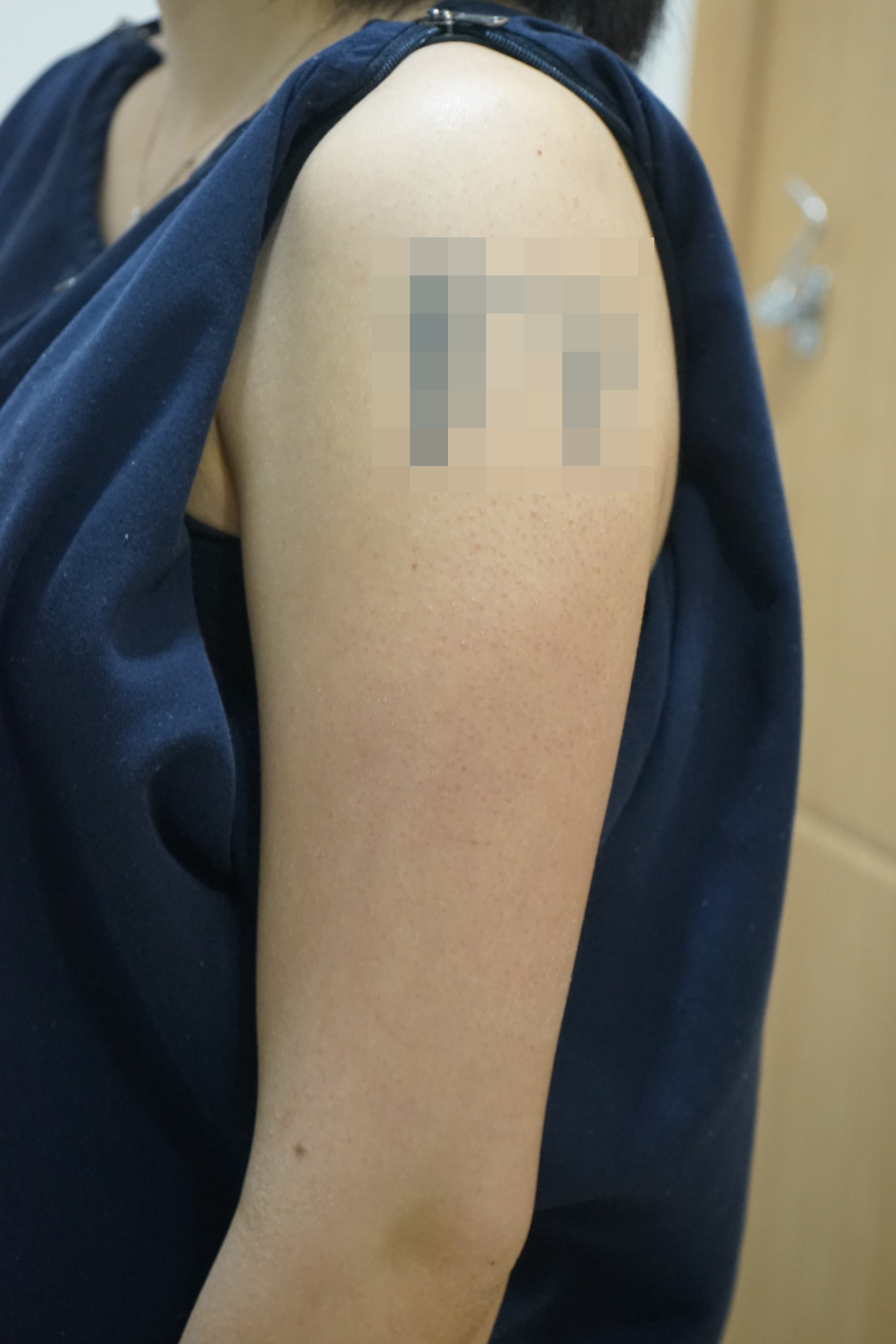 전후사진