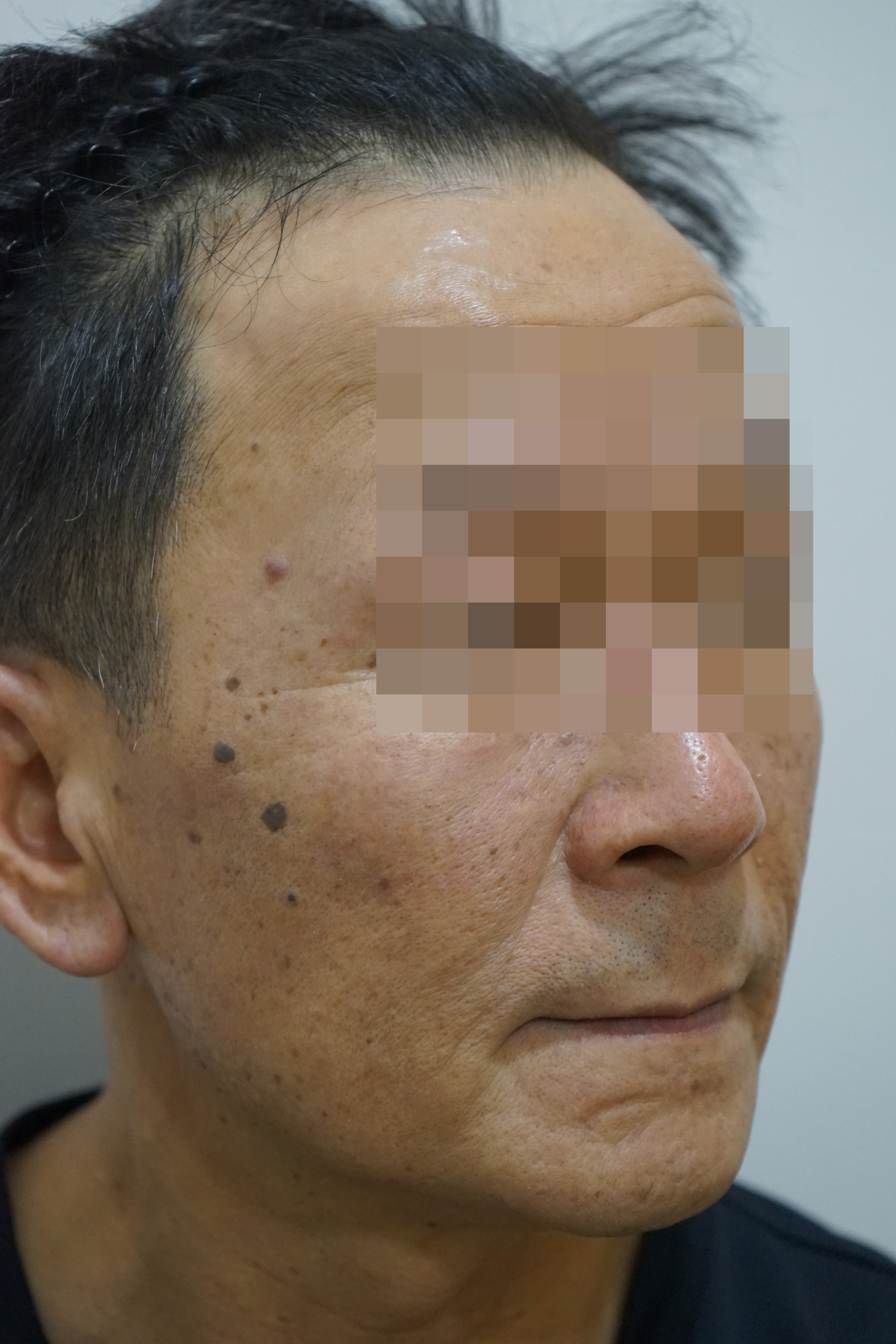 전후사진