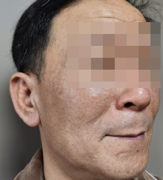 전후사진