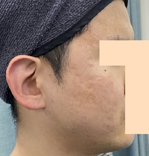 전후사진