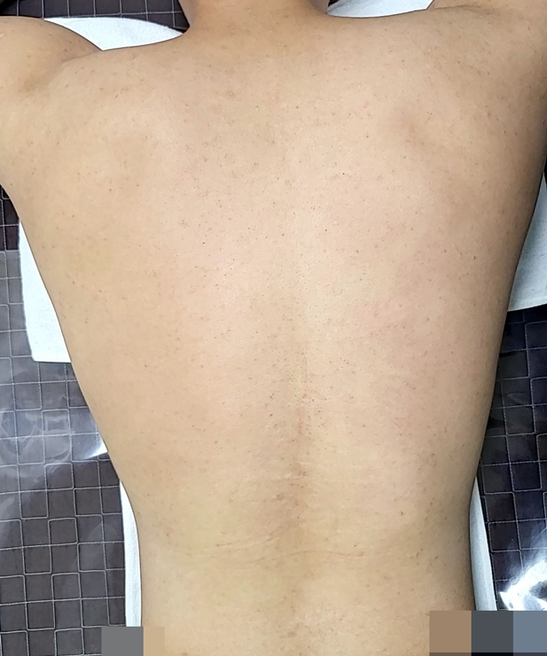 전후사진