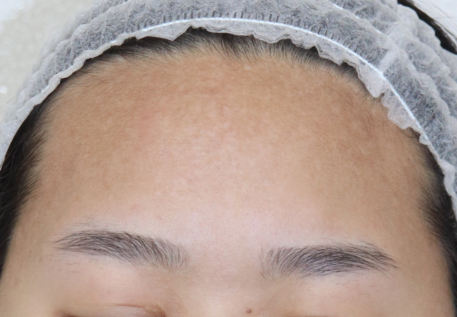 전후사진