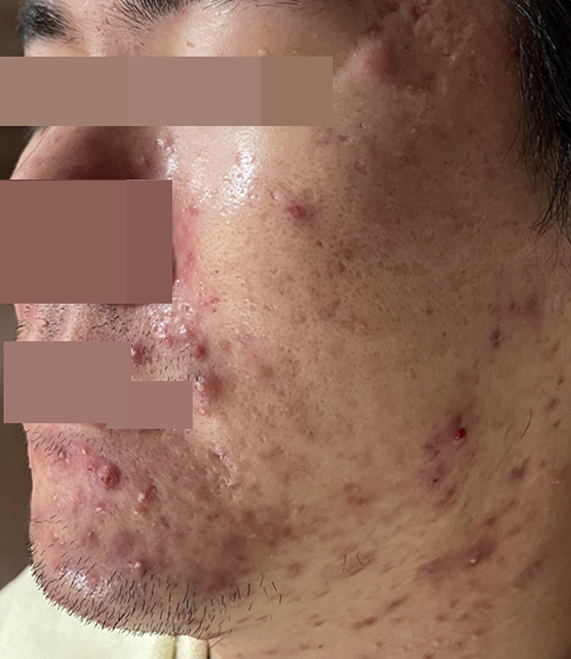 전후사진