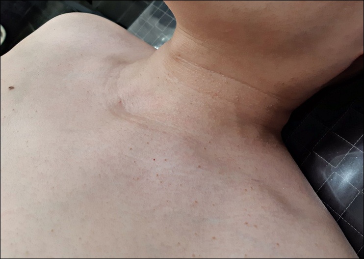 광주점 치료 전