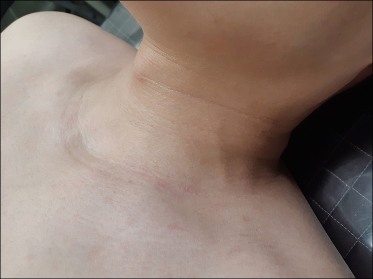 광주점 치료 후