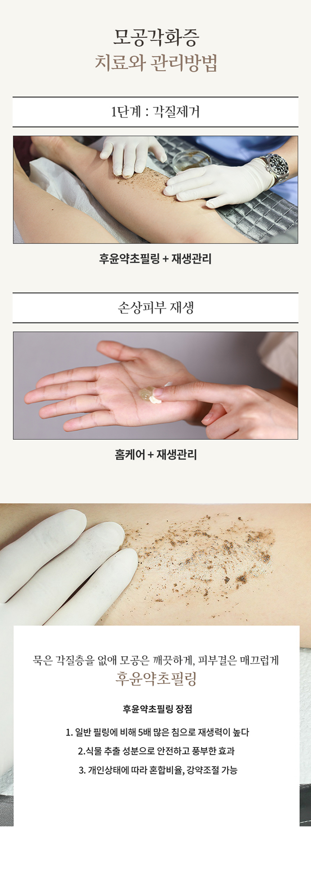 모공각화증