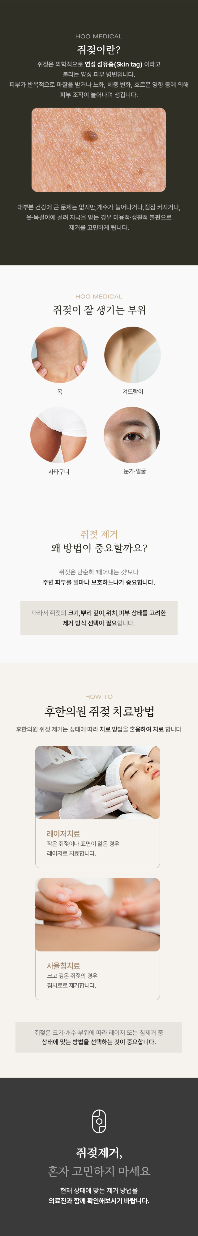 쥐젖